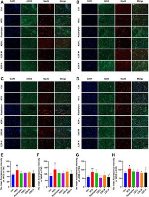 Xiongshao Zhitong Recipe Attenuates Nitroglycerin-Induced Migraine-Like Behaviors via the Inhibition of Inflammation Mediated by Nitric Oxide Synthase